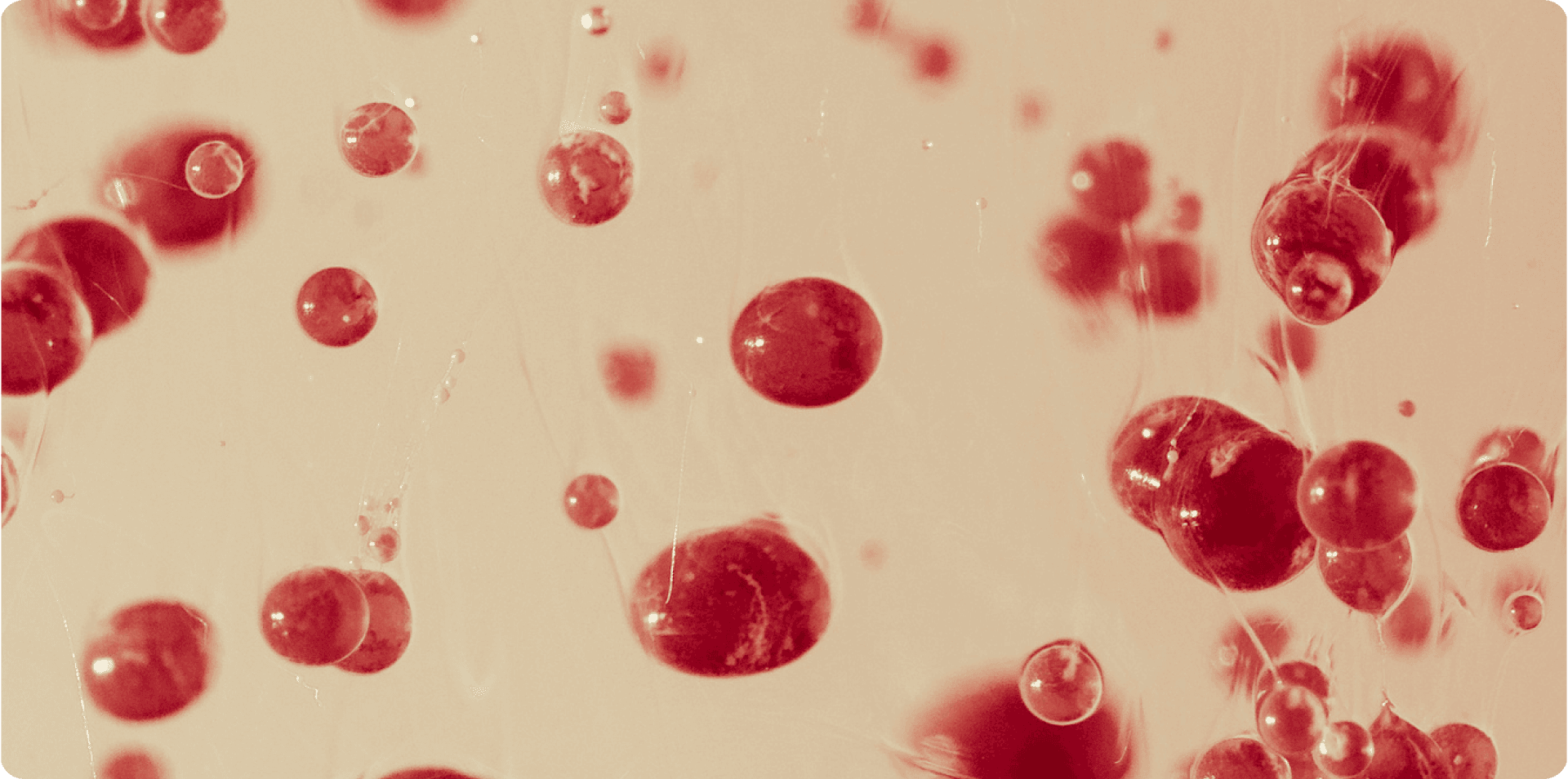 AI-powered diabetic retinopathy screening at scale.